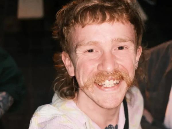 都柏林一名摄影师骑自行车上班时“被压在了公交车下面”，他“庆幸自己还活着”