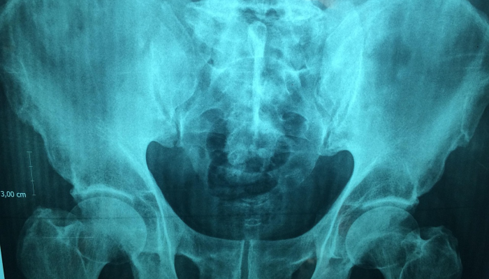 玩家辅助神器:“雅苑蕲春麻将破解版”(曝光透视必备猫腻) 玩家辅助神器:“雅苑蕲春麻将破解版”(曝光透视必备猫腻)