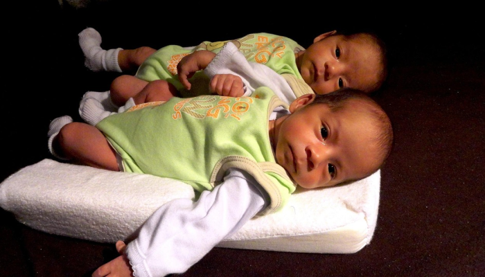 双胞胎的类型:同卵,异卵和更多 双胞胎的类型:同卵,异卵和更多