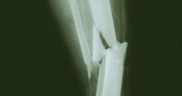 玩家必看教程“开心泉州麻将怎么打会赢”(原来确实是有挂) 玩家必看教程“开心泉州麻将怎么打会赢”(原来确实是有挂)